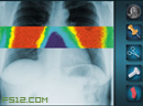 X光机透视人体